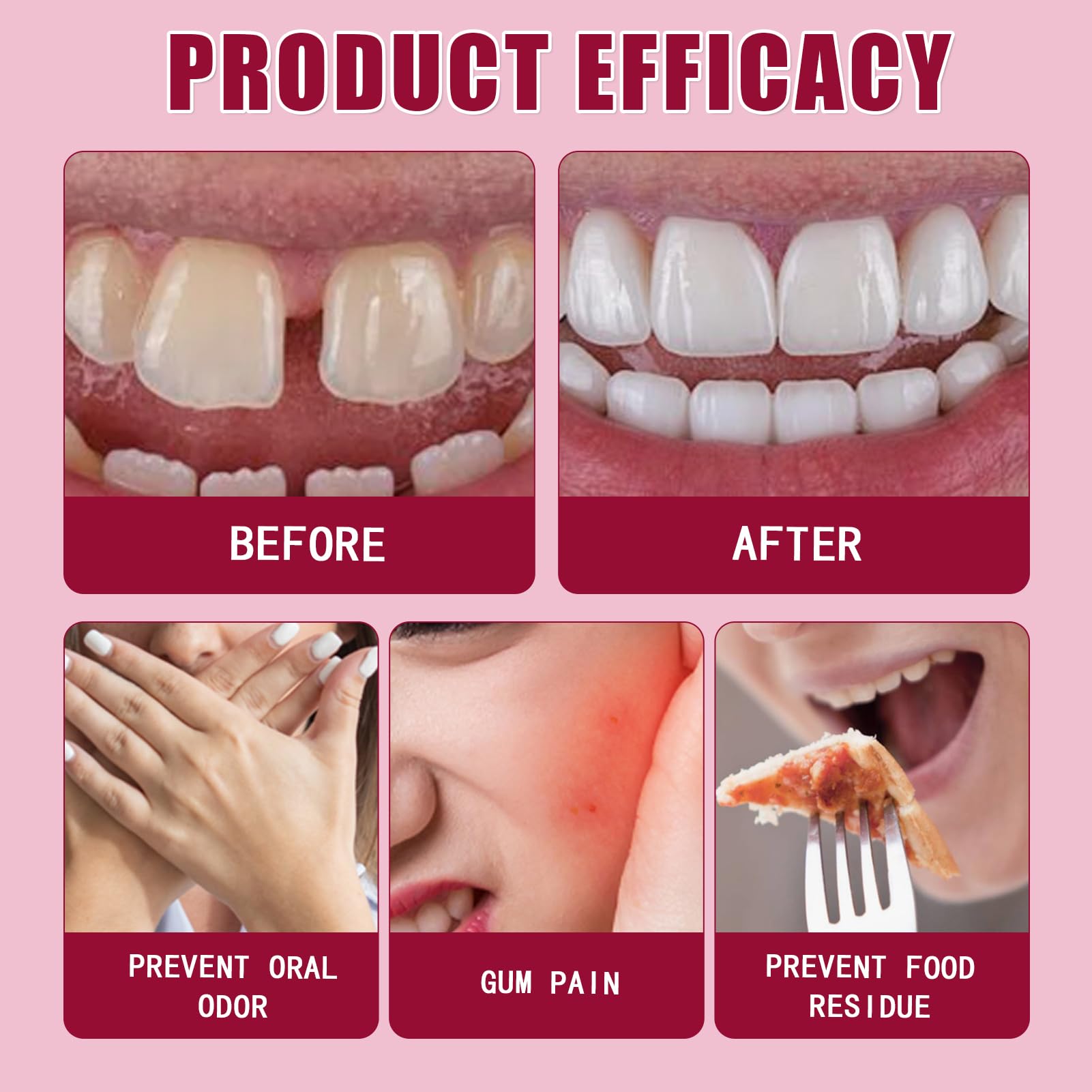 2 unidades de pegamento termoplástico para prótesis dentales, gel adhesivo para dentaduras postizas, crema adhesiva para dentaduras postizas termoplásticas