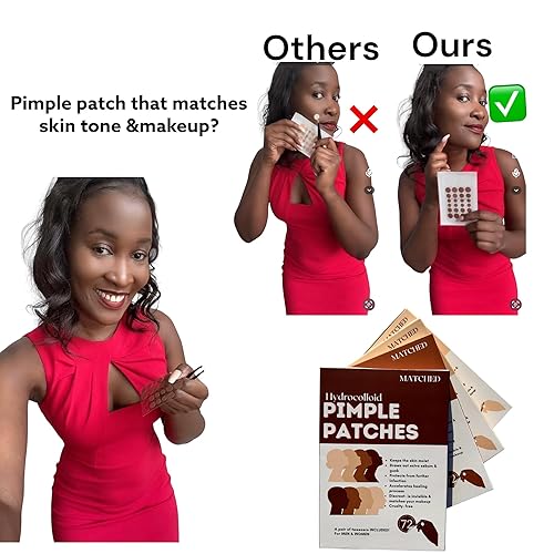 Miniatura 5 de Parches hidrocoloides a juego para espinillas - Parches invisibles para acné para cara, 3 tamaños, 72 unidades (1 paquete), parches que coinciden