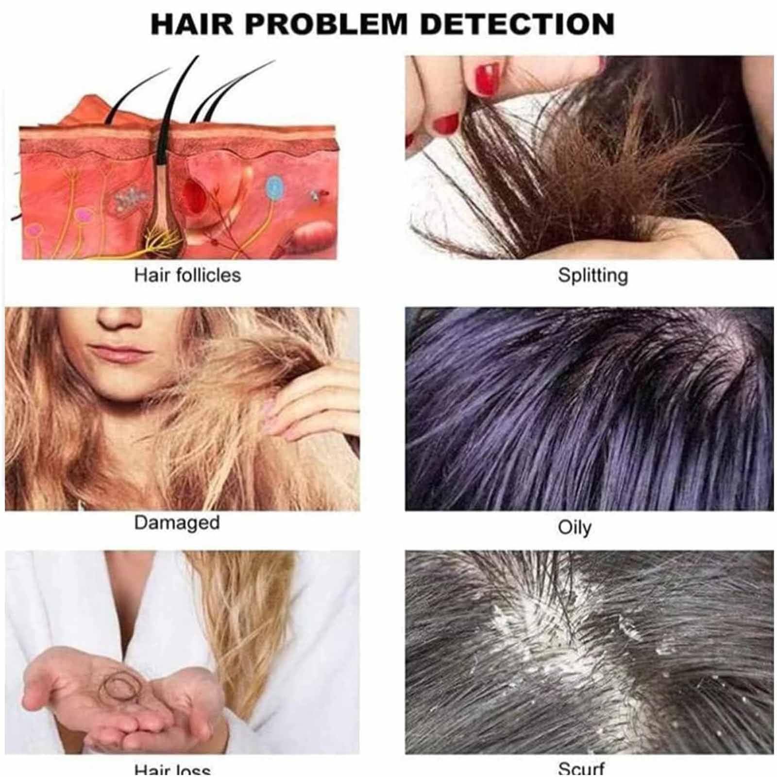 Haut Haar Analysegerät, 10,1 Zoll HD LCD Bildschirm, Mit Vier Rastern/Speicherfunktion 50X/200X Hautvergrößerung, Professionelles Follikelanalysegerät für Zuhause & Salon