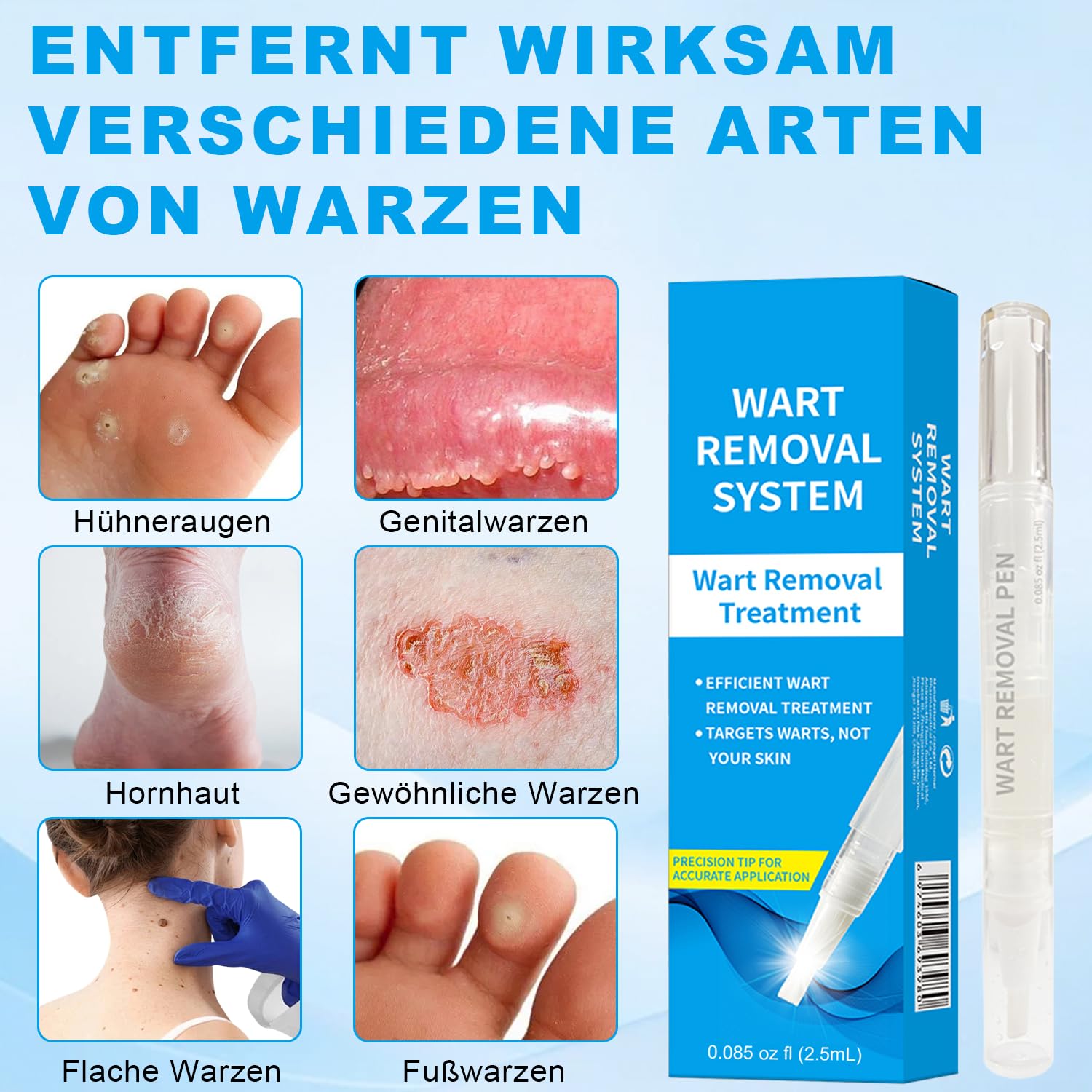 Sanfte Warzenentfernung für Gesicht & Körper - Schnell wirkendes Serum mit Präzisionsbürstenkopf gegen Hautirritationen, Dornwarzen & Flachwarzen, Sanfte Formel für sensible Haut, Reisegröße (2.5ml)