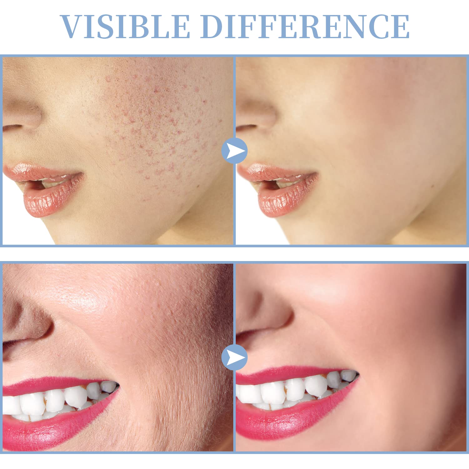 High Frequency Facial Machine TUMAKOU Portable Handheld High Frequency Facial Skin Wand