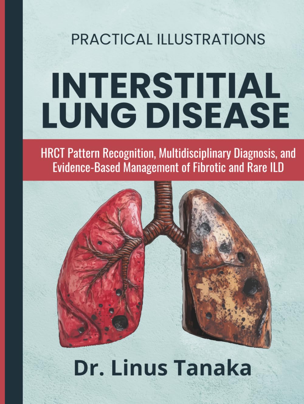 Interstitial Lung Disease Manual: HRCT Pattern Recognition, Multidisciplinary Diagnosis, and Evidence-Based Management of Fibrotic and Rare ILD