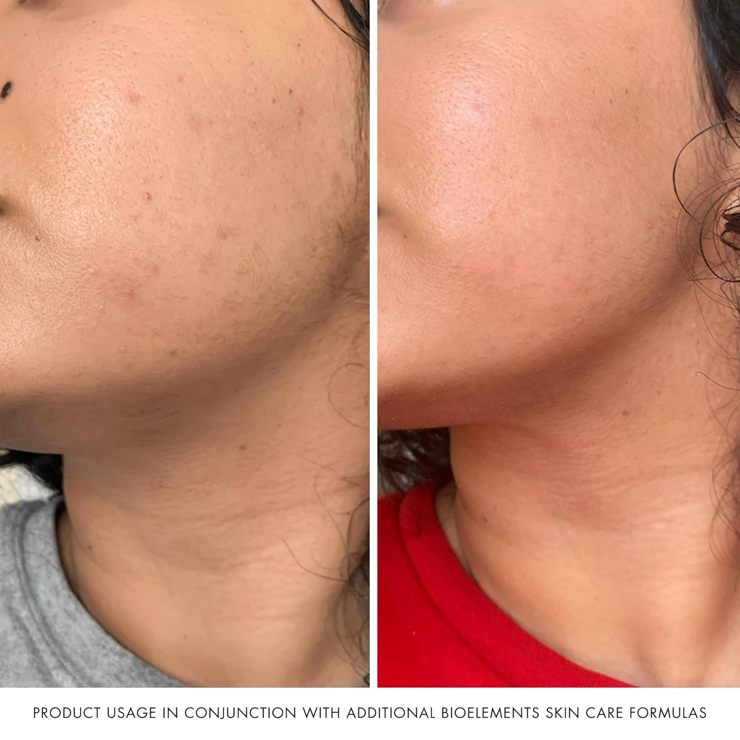 Bioelements vc10 Daily Glow - 1 fl oz - Glow-Getting Serum with Triple-Sourced Antioxidant 10% Vitamin C - All Skin Types - Vegan, Gluten Free - Image 5