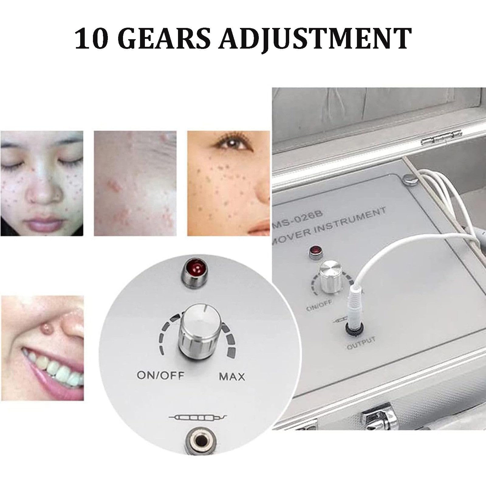 Lápiz De Plasma Láser De 10 Niveles, Lápiz Electrónico para Eliminar Lunares Y Tatuajes, Herramienta De Belleza para El Cuidado Facial, para Eliminar Manchas Oscuras, Pecas, Nevos Y Verrugas