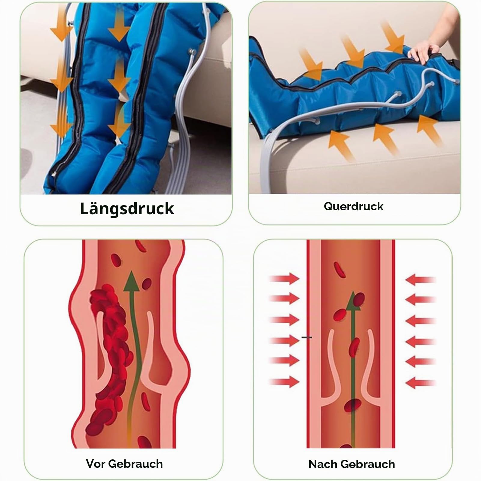 Lymphdrainage Gerät Beine Bei Lipödem, Venen Massagegerät Mit Timer-Funktion, Beinmassagegerät Mit 6 Luftkammern Einstellbarer Druck, Ideal Bei Lipödem, Wassereinlagerungen Und Schwellungen