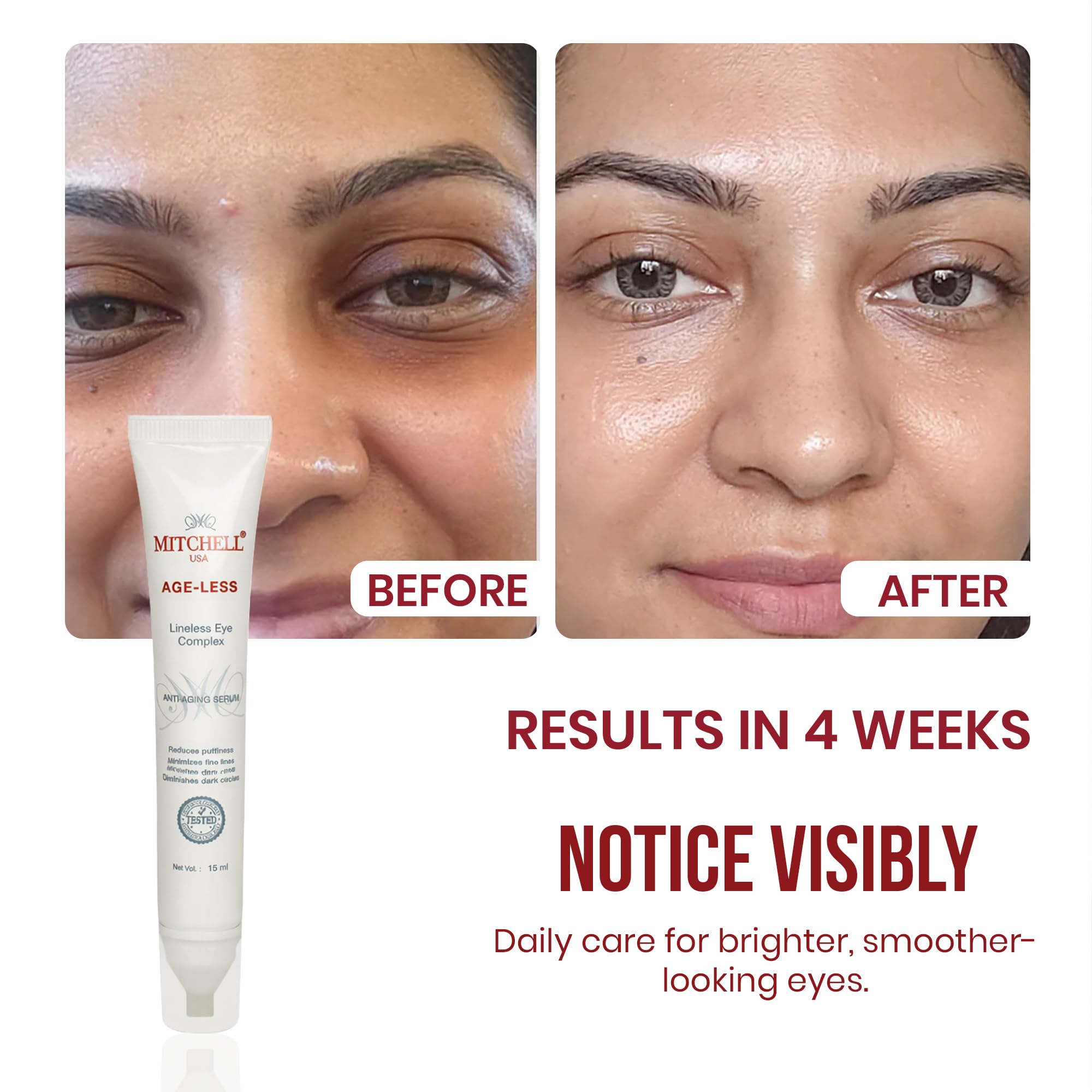 Mitchell USA Lineless Eye Serum – Peptide & Lotus Bio-Repair – Reduces Dark Circles, Wrinkles & Puffiness Lightweight Anti-Aging Formula 15ml 1