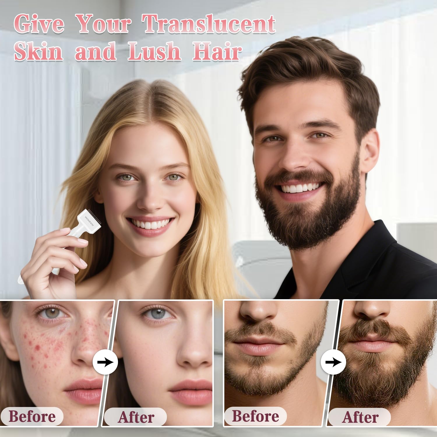 Derma Stamp, RRZIOM Microneedling Derma Stamp for Hair Scalp Beard Growth Face Care - Image 3