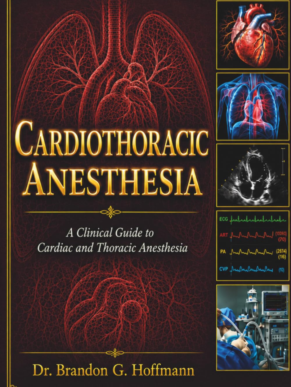 Cardiothoracic Anesthesia: A Clinical Guide to Cardiac and Thoracic Anesthesia
