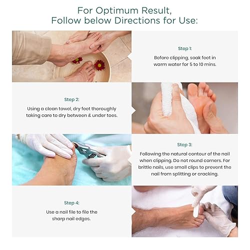 Miniatura 4 de Cortaúñas encarnadas para hombres con uñas encarnadas  Blizzard Podólogo Juego de cortaúñas de pies forjado alemán  Cortador de uñas profesional de
