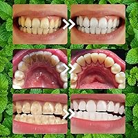 Vista 5 de 2PCS Teeth Restoration Mineral Powder,Mineral Tooth Powder,Teeth Whitening Mineral Powder, Effective in Strengthening Teeth and Gums, Dental
