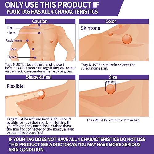 Miniatura 7 de ANTIXYL Kit líquido de eliminación de manchas cutáneas, removedor de maíz de verrugas, de acción rápida, congelación, 8% de eliminación de verrugas