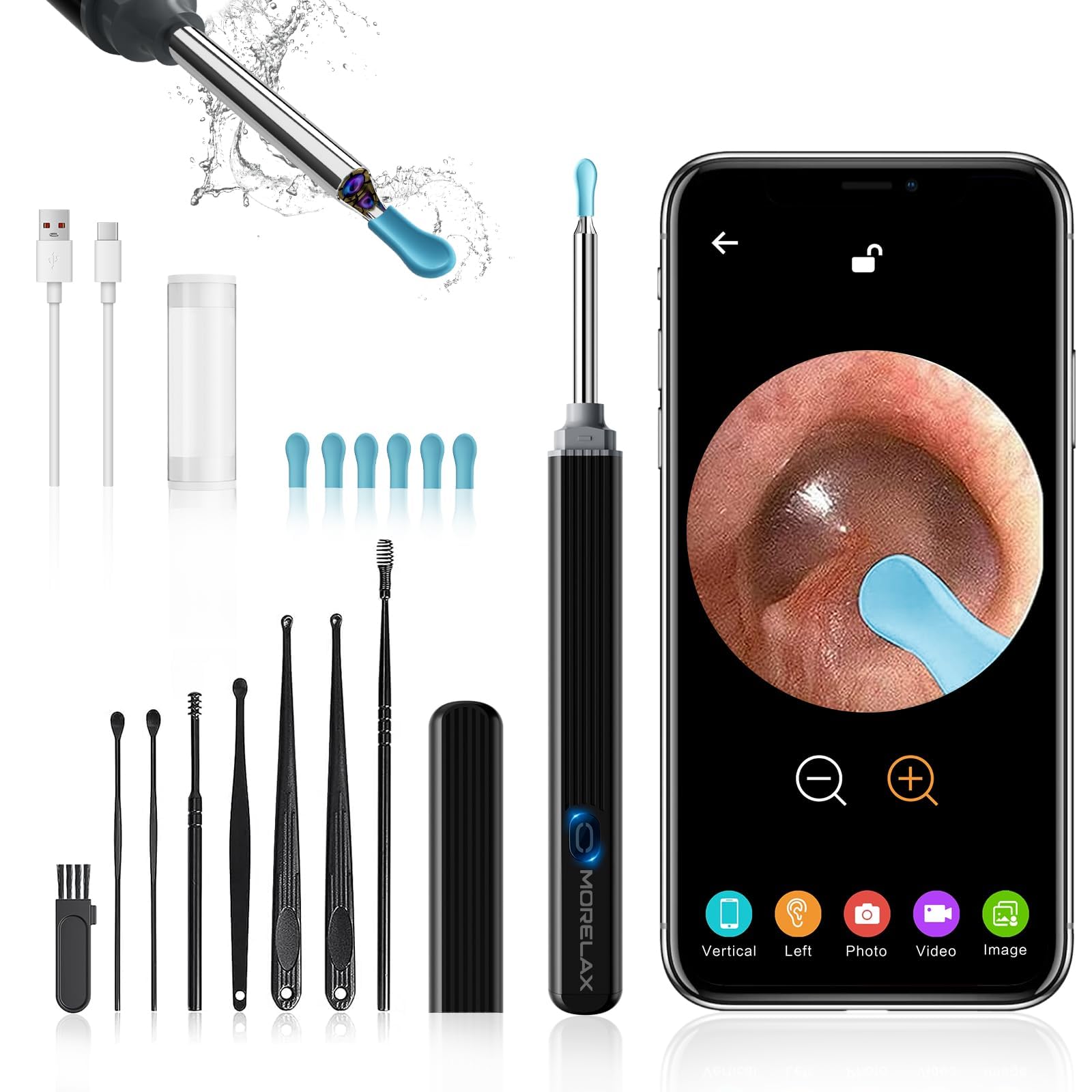 Otoscope Oreille avec caméra 1080P HD 3,5 mm étanche 6 Lumières LED pour Smartphones et Tablettes IOS Android Noir