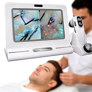 Professional Scalp Detector Magnification Hair Analyzer 50X/200X with Dual Handle Probes for Salon Diagnosis