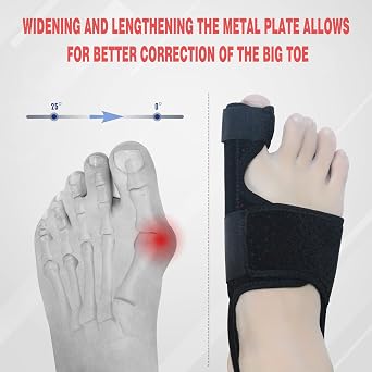 MOONSMILE Bunion Corrector for Women & Men (Black/Red)