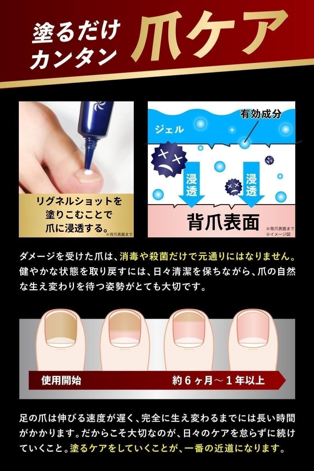 Amazon.co.jp: 【ドクター在籍会社が開発】 リグネルショット 爪消毒