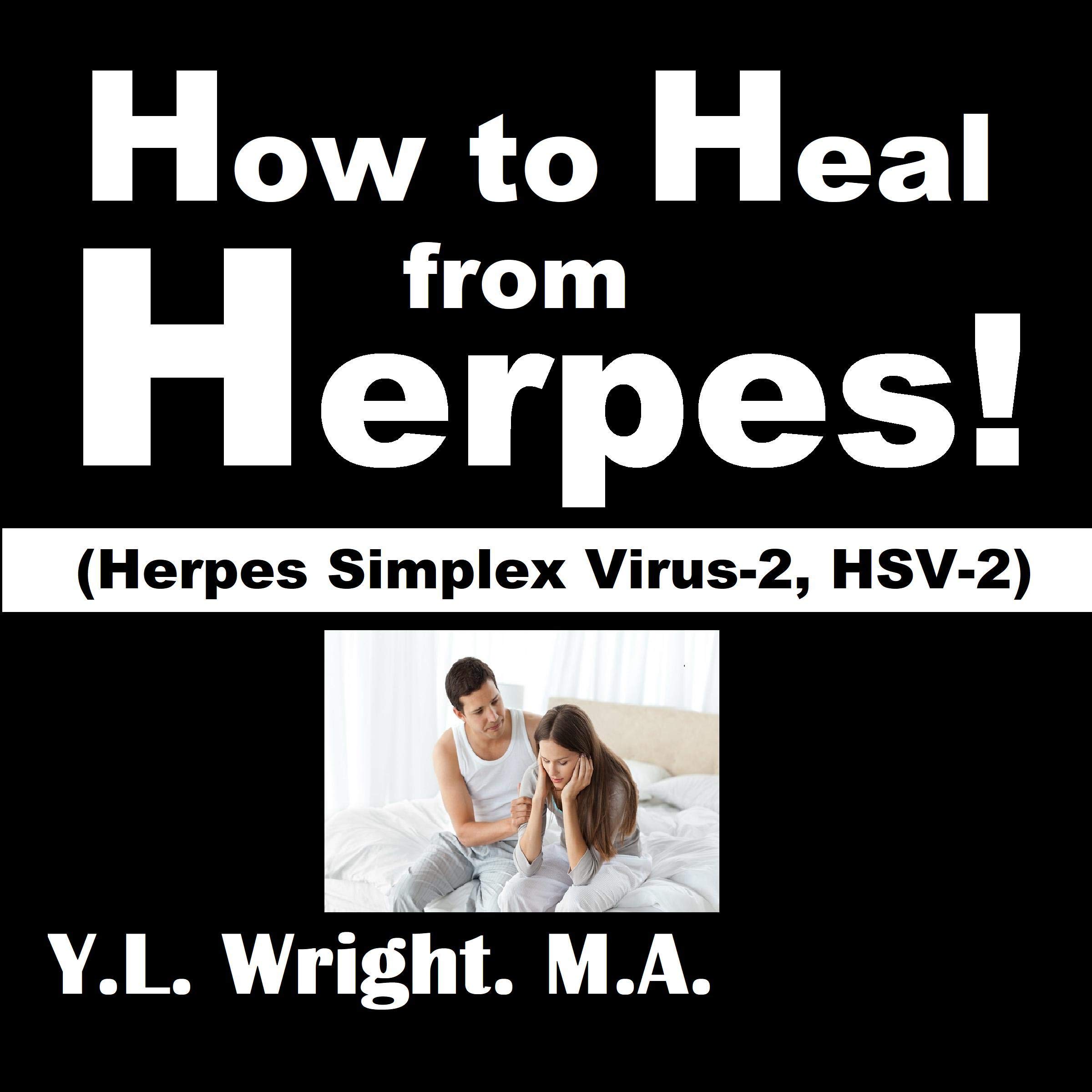 How to Heal from Herpes!