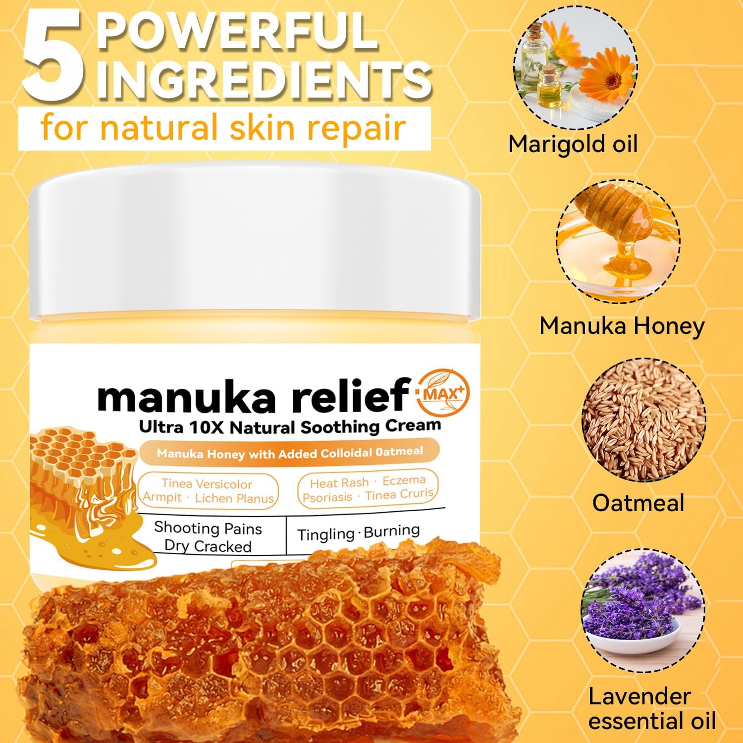 Manuka Honey Cream Max Strength Treat Natural Organic Ointment, Soothing Relief for Itching, Eczema, Psoriasis,Dry, Heat Rash, Leg, Stomach, Armpit, Foot, Hand