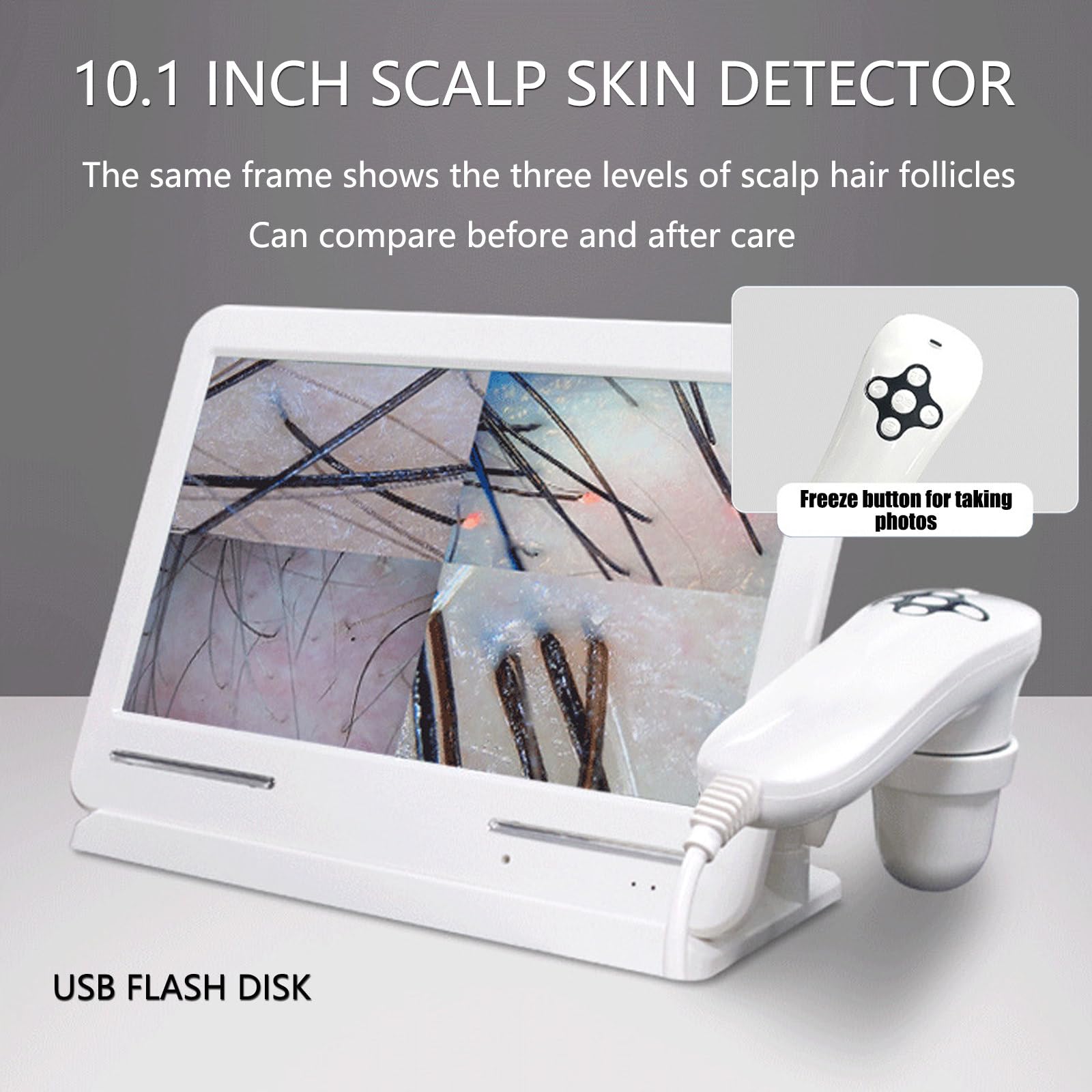 Analizator włosów, maszyna do diagnostyki Skin Scope, 10,1-calowy 50x 200x cyfrowy mikroskop z ładowaniem, detektor włosów na skórze głowy, do testowania mieszków włosowych i analizy skóry