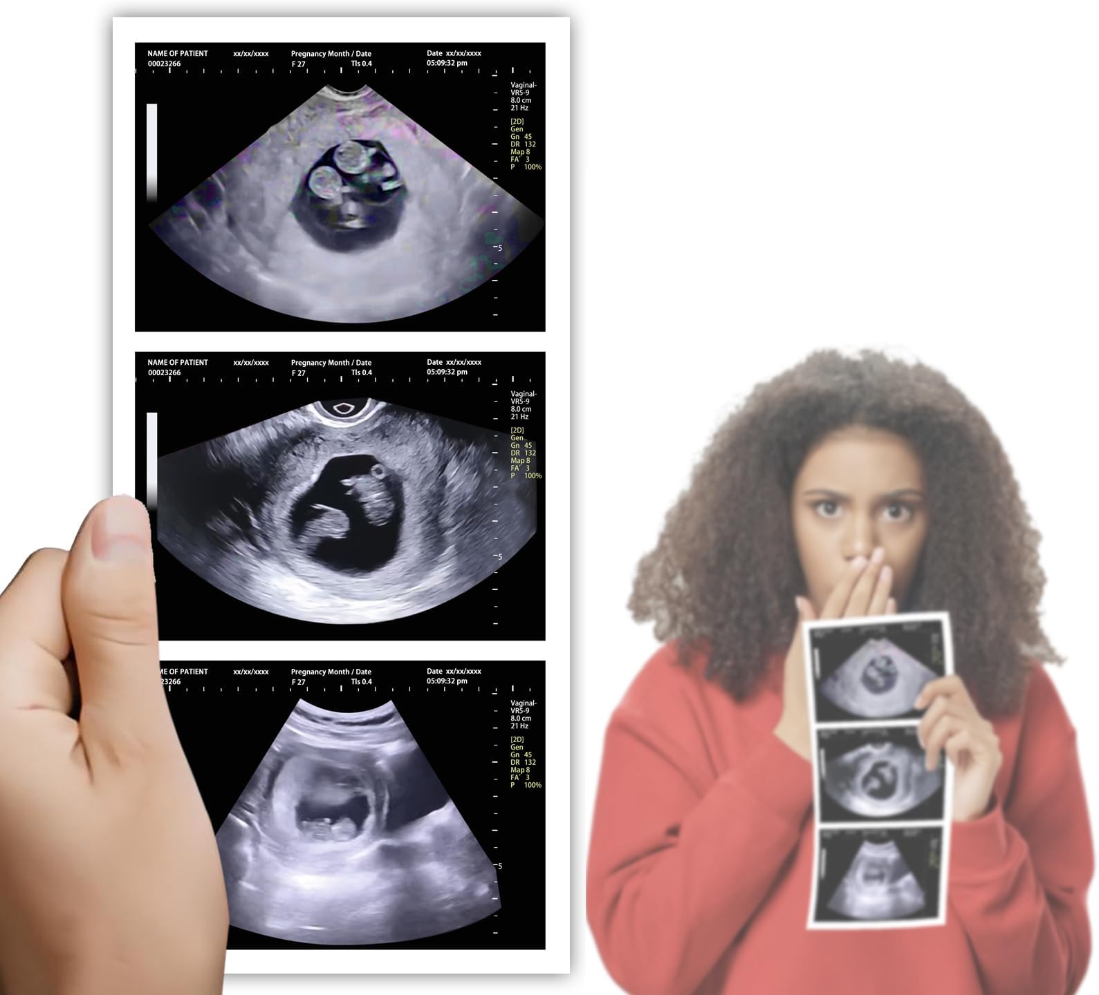 Personalized Fake Prank Ultrasound with 3 Photos Customized Prank Pregnant Sonogram Gag Gift for Family and Boyfriend (Twins 10 Weeks)