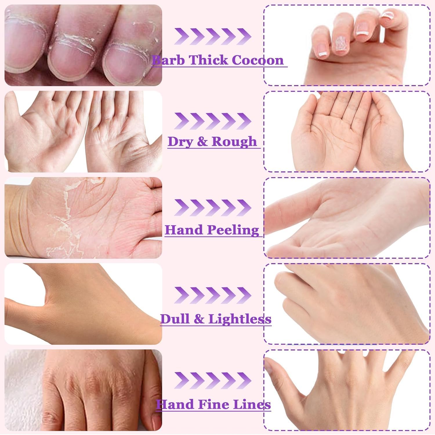 Drofail Moisturizing Hand Masks Hydrating Gloves Socks Masks for Dry Foot Hand Skin Gift for Women Men Refreshing Hand Care (Lavender-Pack 1) 2