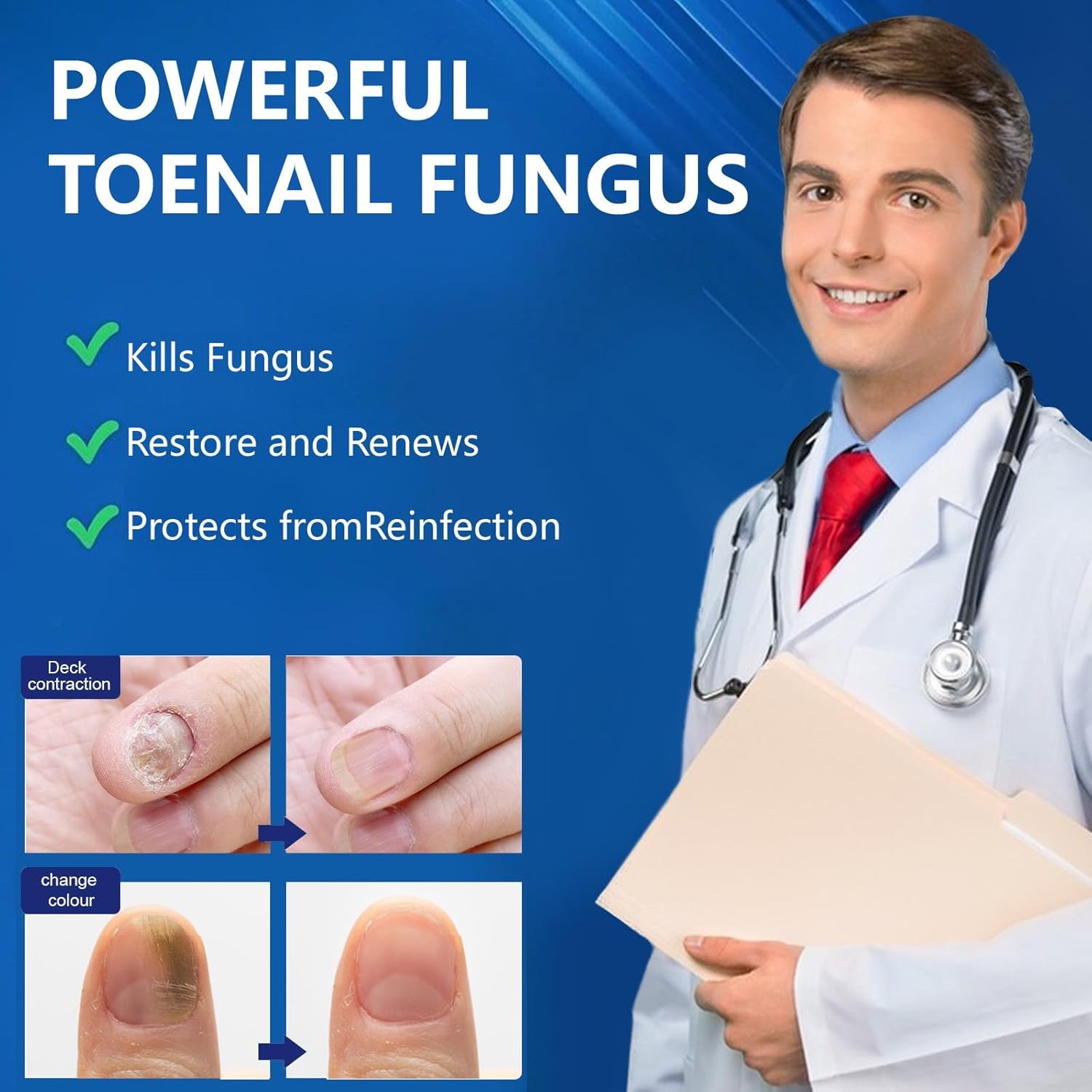 Toenail Fungus Treatment Extra Strength, 30ML Fungus Nail Repair Liquid with 1% Tolnaftate, Fast Acting Treatment for Discolored & Damaged Nails, Athletes Foot - Image 7