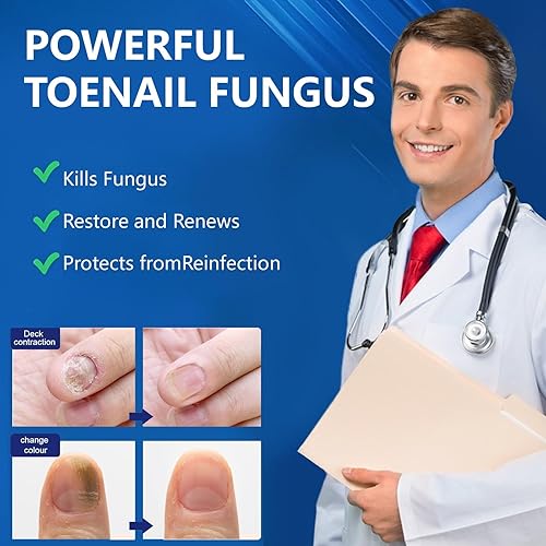 Miniatura 7 de Tratamiento de hongos en las uñas de los pies extra fuerte, 30ML líquido de reparación de uñas de hongos con 1% de tolnaftate, tratamiento de acción