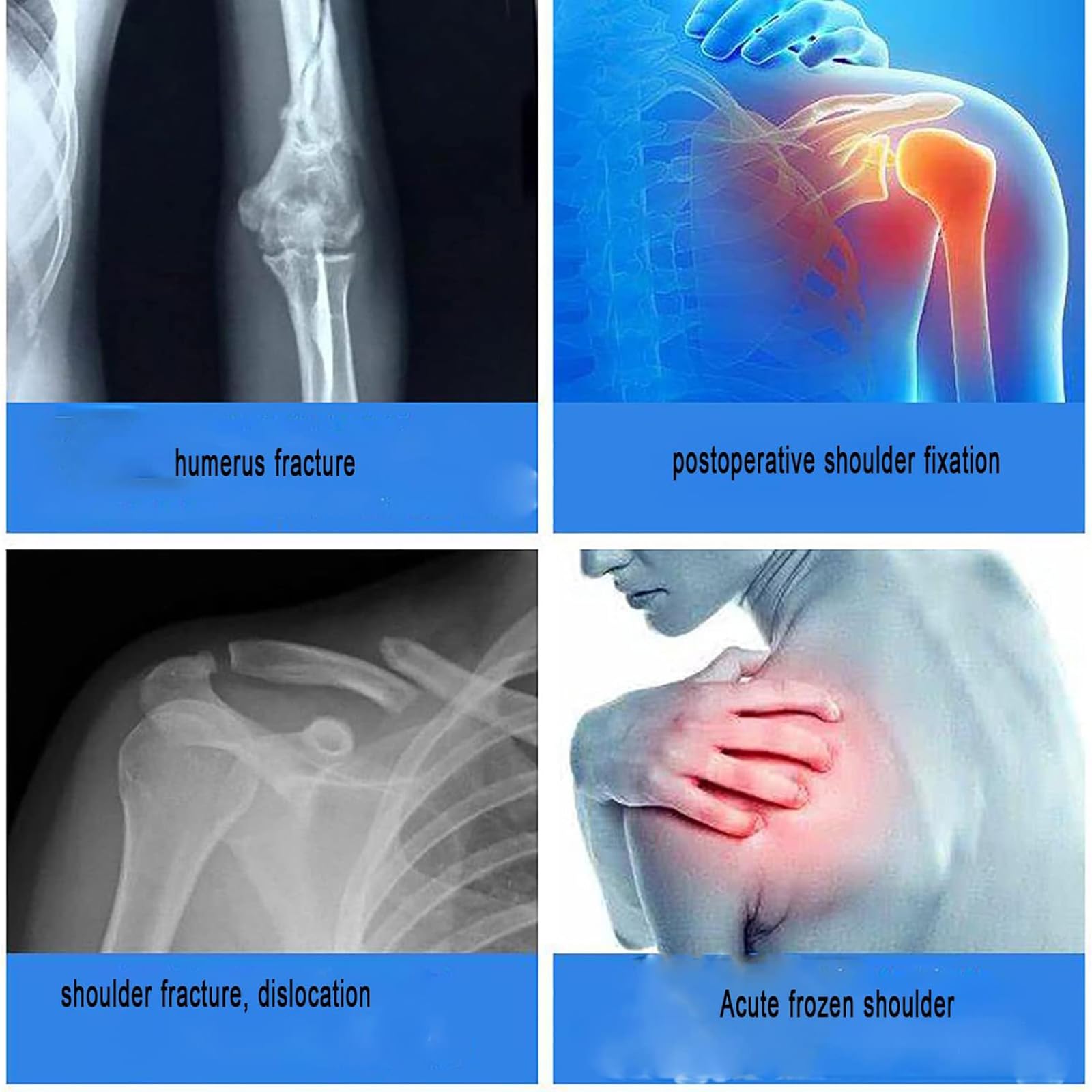 Soporte Fijo para abducción de Hombro, órtesis para articulación del Hombro, ángulo Ajustable: 0-120°/tamaño de Correa Ajustable, para Hombro congelado Agudo/Fractura y distensión del Hombro
