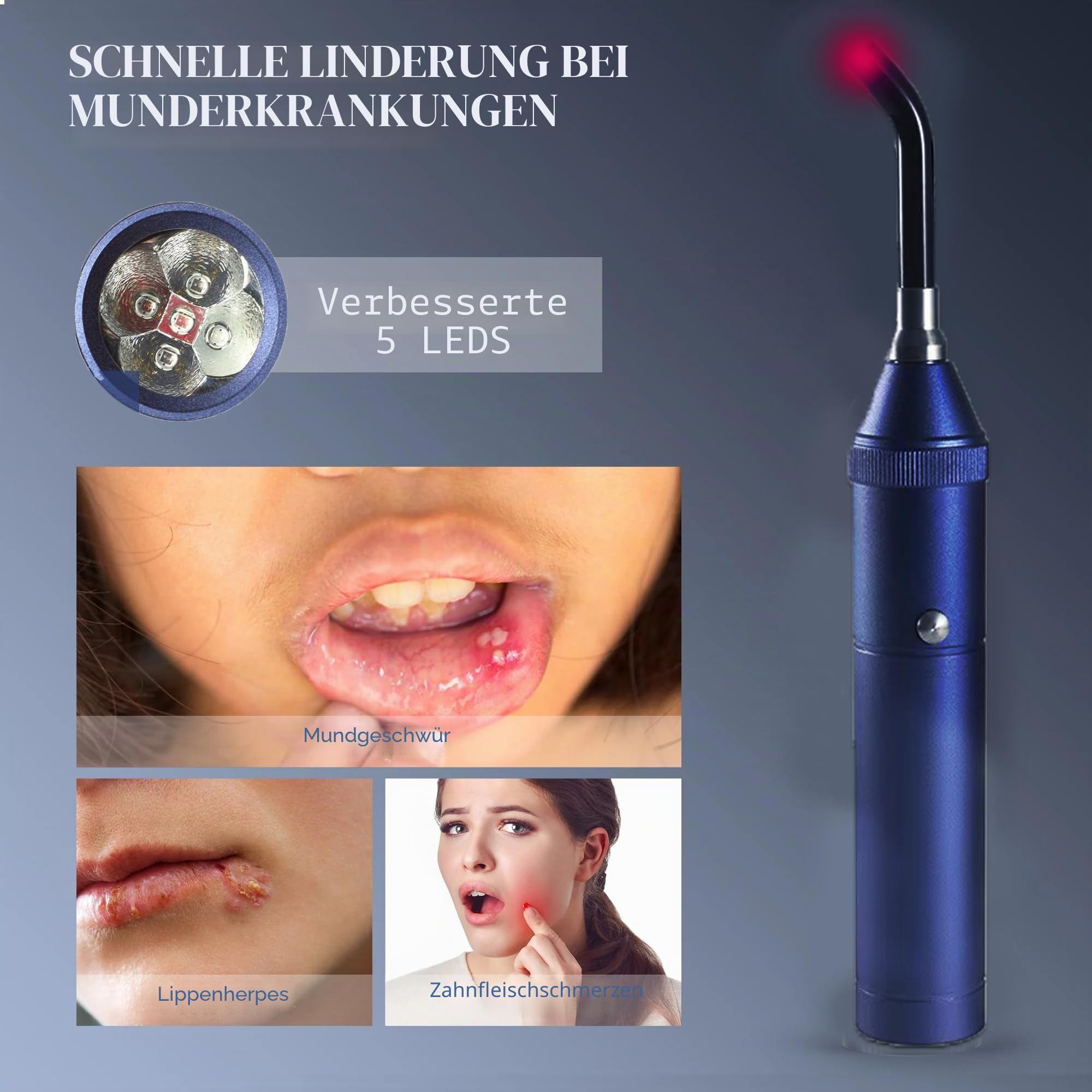 Rotlichttherapie Gerät – 3-in-1 Rotlicht, wiederaufladbar für Mundgeschwüre, Lippen & empfindliche Bereiche