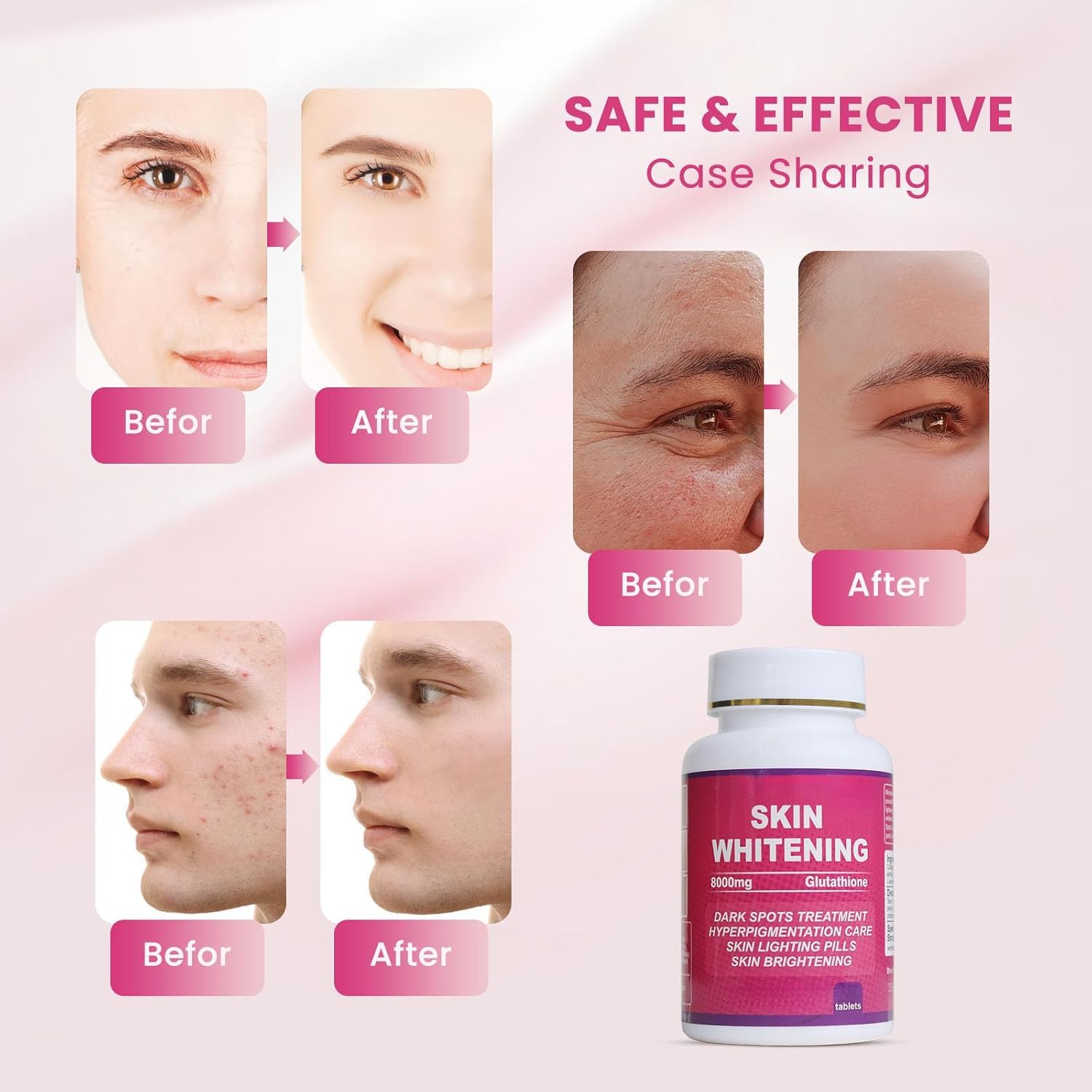 Glutatione 8000 mg Sbiancamento Pelle Rimozione Lentiggini Cloasma Schiarimento Tono
