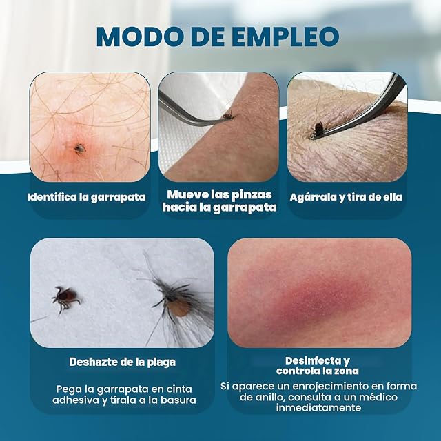 Foto 3 de 8 de REMOS Pinzas para garrapatas inoxidable con punta curvada - humanos y animales