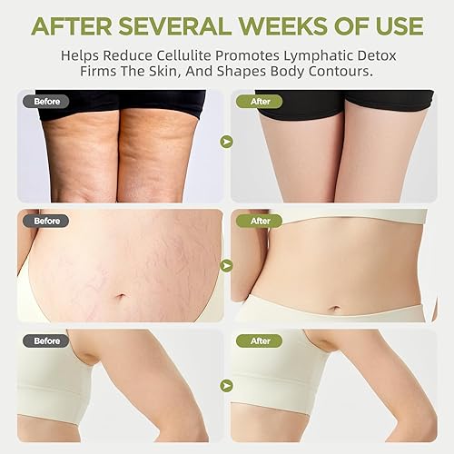 Miniatura 5 de Masajeador de drenaje linfático y herramienta de masaje anticelulitis