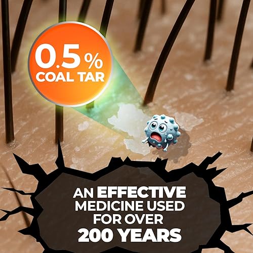 Miniatura 7 de MEDICASP Shampoo anticaspa con alquitrán de hulla Trata la caspa dermatitis seborreica y psoriasis 6 onzas líquidas