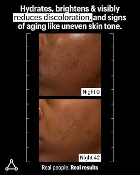Allies of Skin Mandelic Pigmentation Corrector Night Serum | Gentle Acne Face Serum with Bakuchiol, Niacinamide & Salicylic Acid | Anti-Aging Formula to Reduce Pores and Even Skin Tone (1 oz)