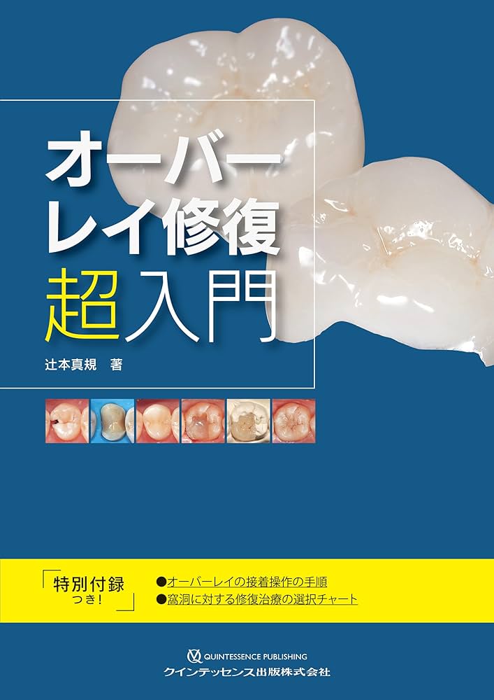 【裁断済】オーバーレイ修復超入門 オーバーレイ修復 超入門 | 辻本真規 |本 | 通販 | Amazon