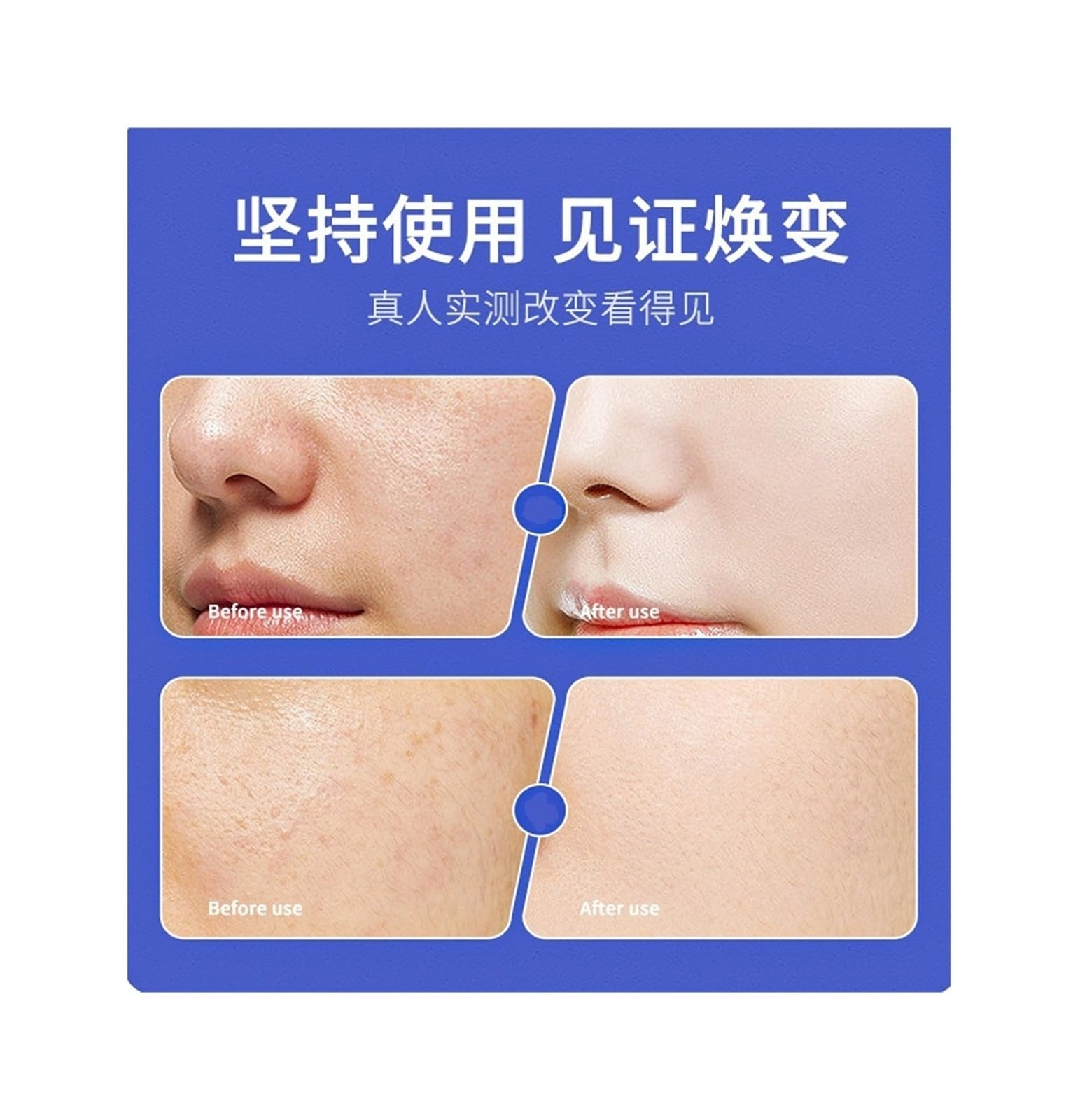 Limpiador facial iluminador y eliminador de manchas, 120 ml | Limpia profundamente los poros, unifica el tono de la piel e ilumina la piel apagada.(2pcs)