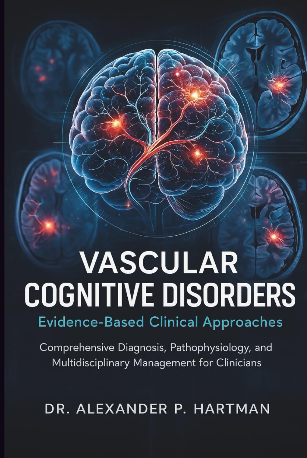 Vascular Cognitive Disorders: Evidence-Based Clinical Approaches: Comprehensive Diagnosis, Pathophysiology, and Multidisciplinary Management for Clinicians