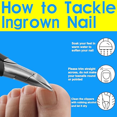 Miniatura 8 de Cortaúñas para uñas gruesas y encarnadas, herramienta de uñas encarnadas con 100 parches de corrección de uñas de los pies, kit de eliminación de