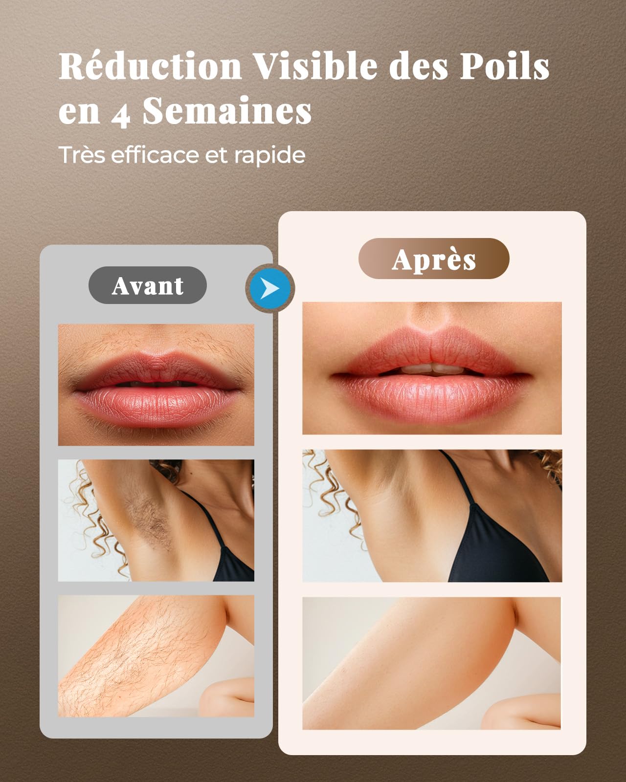 Haarlosy Épilateur Lumière Pulsée, Grande Fenêtre 5 cm², 999,900 Flashs IPL, 9 Niveaux & 2 Modes, Auto/Manuel – Épilation Laser Définitive Maison Femme & Homme, Visage, Corps, Aisselles, LCN1202