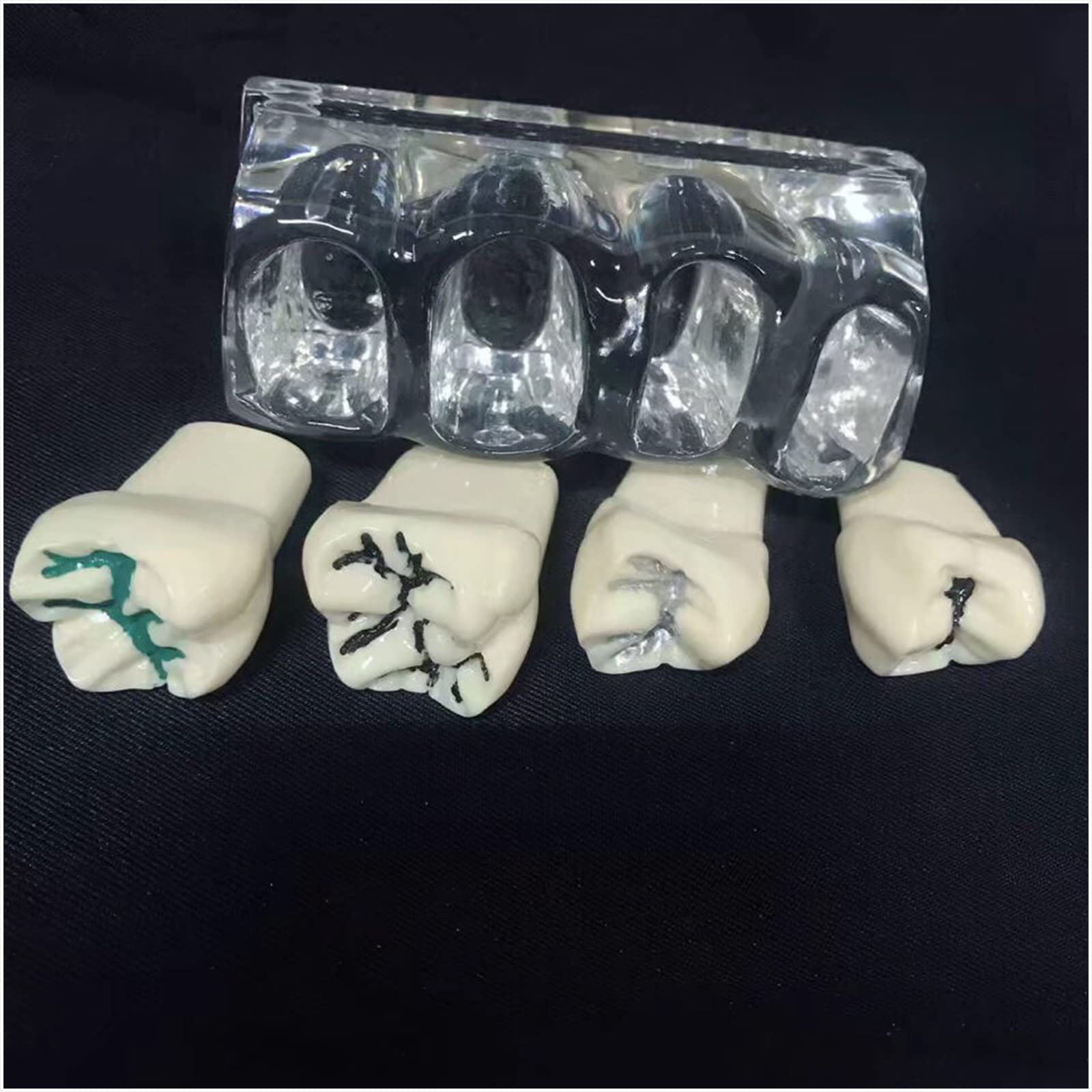 Dental Pit Fissure Caries Sealant Study Modell – Bildungsmodell Zahnpflege Lernmodell – für Unterricht Demonstration, Laborbedarf (weiß)