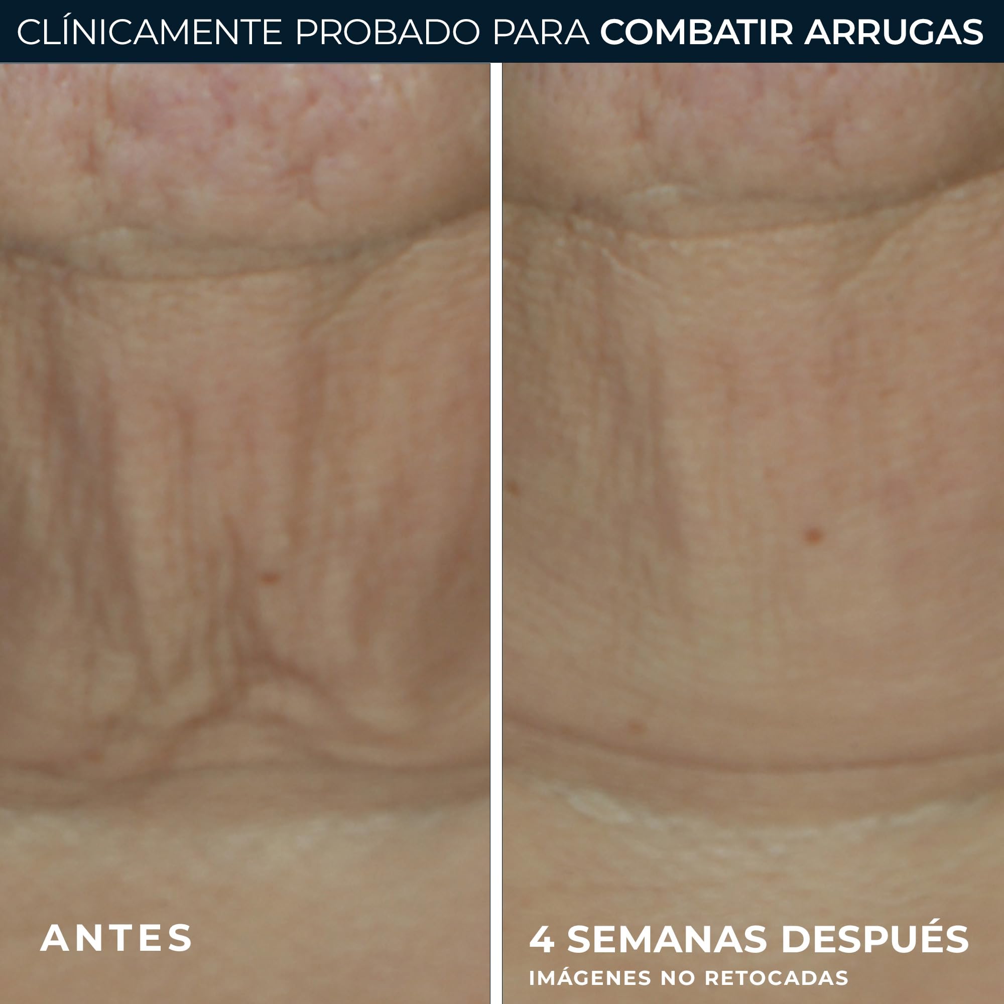 RoC DERM CORREXION FIRMING SERUM STICK