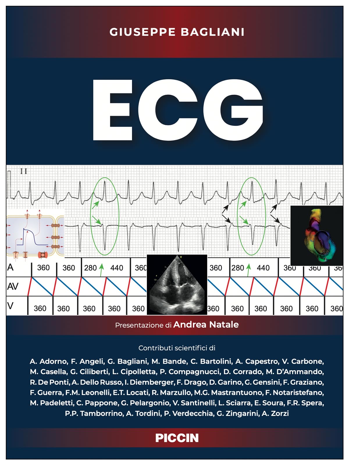 ECG