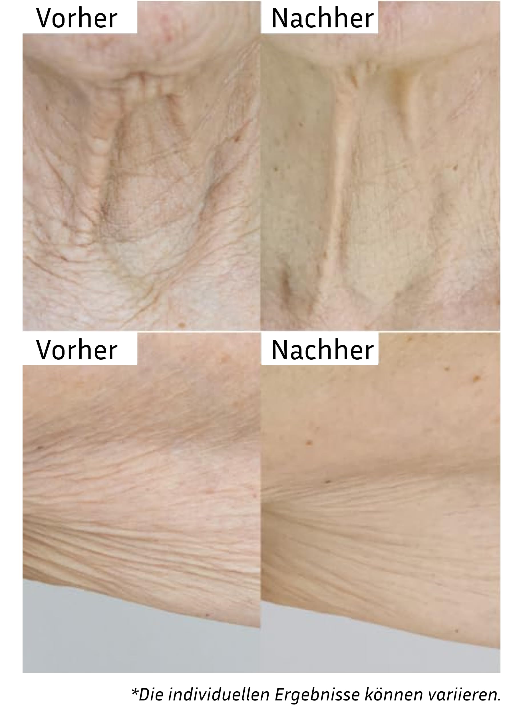 City Beauty InvisiCrepe Körperbalsam – Hautstraffende und festigende Lotion für ein glatteres, strafferes Aussehen | Anti-Aging-Straffungscreme für den Körper