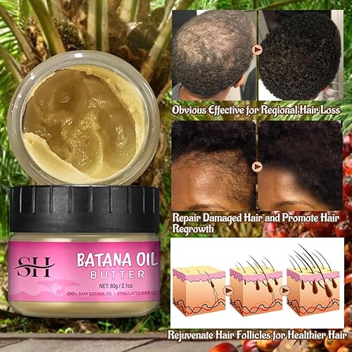 Miniatura 3 de gowwim Aceite de batana puro, 100% aceite de batana para el crecimiento del cabello, Dr. Sebi, aceite vegetal natural para el crecimiento del