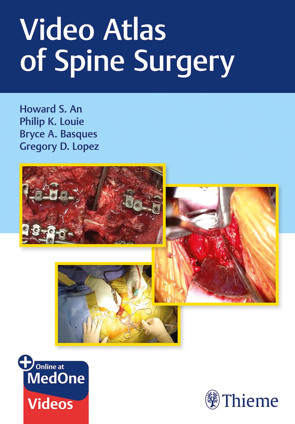 Video Atlas of Spine Surgery: Mit E-Book