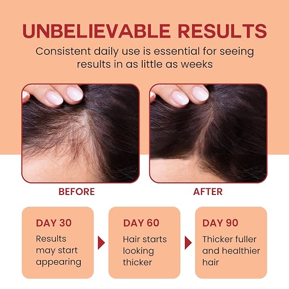 Lebanta Raw Batana Oil for Hair Growth - 100% Pure, Organic 4oz Batana from Honduras for Thick and Strong Natural Hair - Dr. Sebi Unrefined Cold Pressed Cosmetic Scalp Mask for Men & Women (3 Pack)