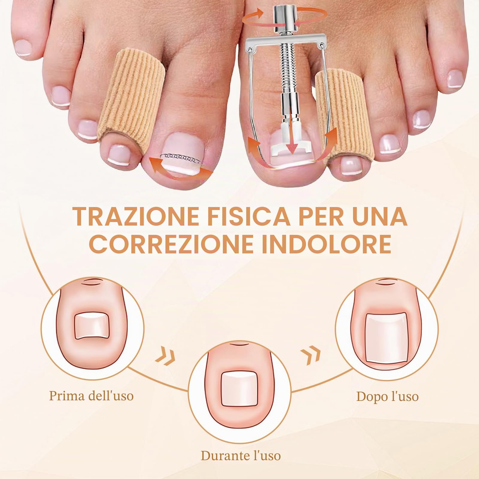 Kit per unghie incarnite, 32 pezzi professionali per la correzione delle unghie incarnite, incluso correttore in acciaio inossidabile e adesivi, sollievo dal dolore, per uso domestico