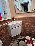 Review Image by SRNA