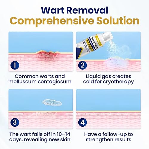 Miniatura 4 de LOVILDS ChillErase - Spray de renovación de golpes, spray profesional de ácido salicílico para la piel, reduce las imperfecciones de la piel para