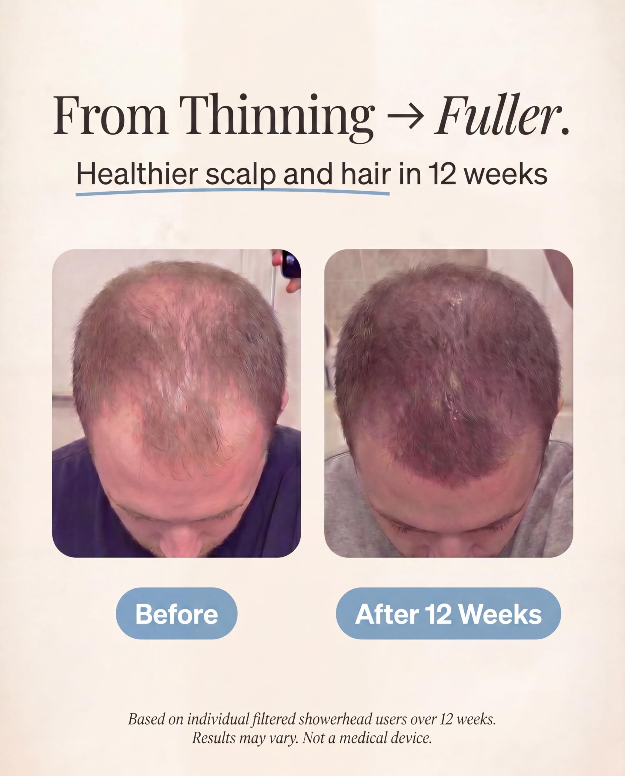 Cabezal de ducha filtrado de alta presión: filtra el cloro, los metales pesados y los microplásticos para una piel más suave y un cabello más saludable, vitamina C y suavizante de agua mineral para