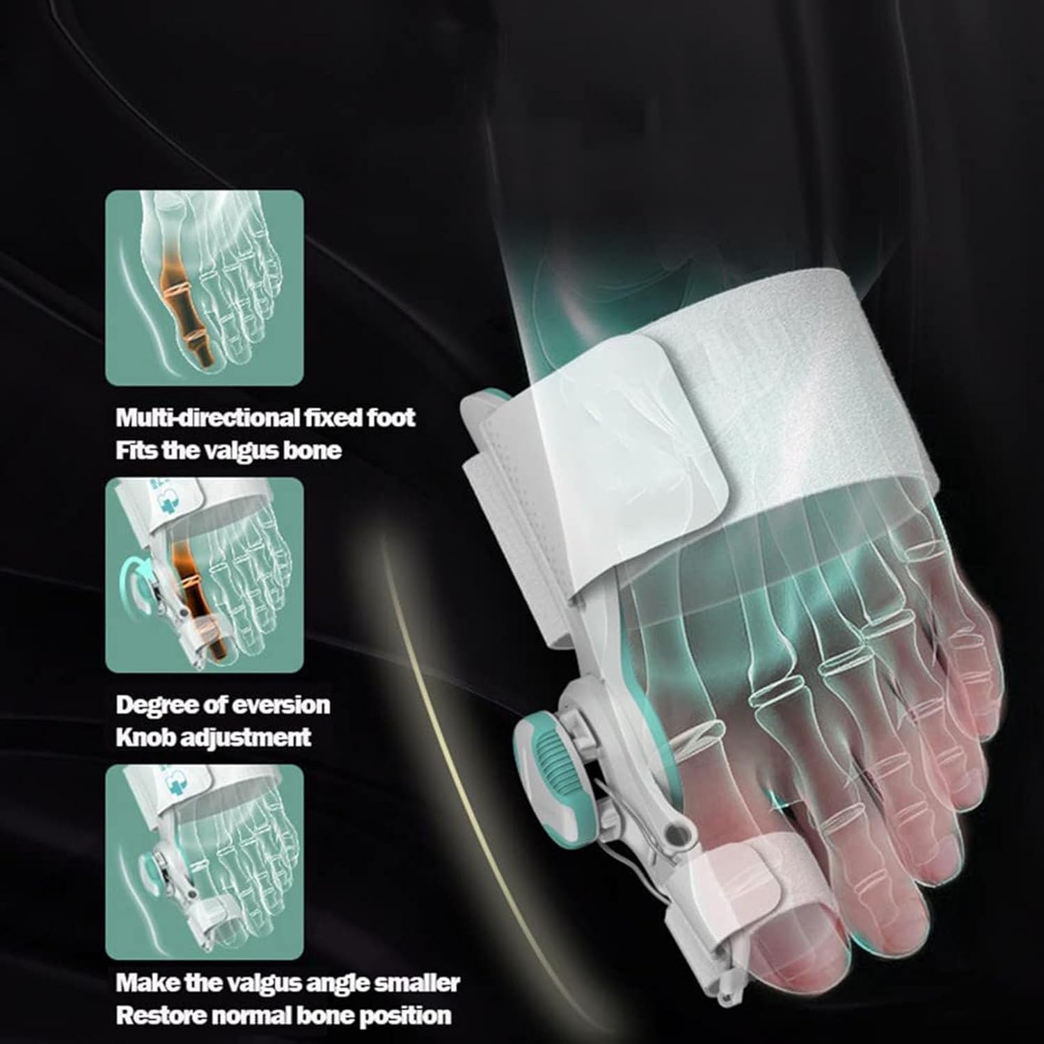 Ortesis para juanetes, enderezador del Dedo Gordo del pie, férula Ajustable para juanetes con corrección de Perilla, restauración del Arco Transversal Correcto, corrección del Hallux valgus